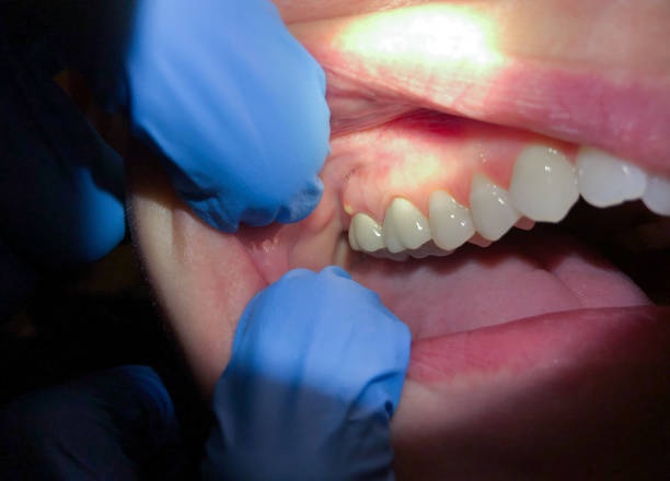 Best Emergency Cosmetic Dentistry in Glencoe, IL