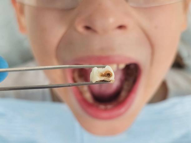 Best Emergency Dental Services for Seniors in Glencoe, IL